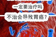 幽门螺杆菌阳性口臭5米都能闻到正常吗幽门螺杆菌阳性口臭