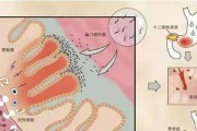 幽门螺旋杆菌的筛查方法幽门螺旋杆菌的筛查方法是