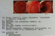 睡醒来胃痛是什么原因？