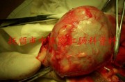 肛周潮湿用什么药膏,肛门潮湿