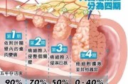 结肠癌早期的症状有哪些,结肠癌早期的症状