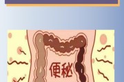 5天不拉屎大便哪去了,5天不拉屎大便哪去了,经常放屁