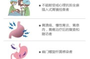 胃镜检查注意事项,超声胃镜检查注意事项 胃镜检查注意事项,超声胃镜检查注意事项