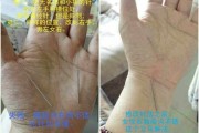 道家针法阴阳九针,道家针法阴阳九针视频