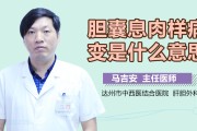 胆囊息肉怎么才能消除5mm,胆囊息肉怎么才能消除 胆囊息肉怎么才能消除5mm,胆囊息肉怎么才能消除