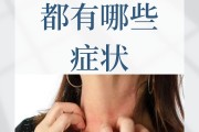 甲醛超标会怎样甲醛超标会怎样处理