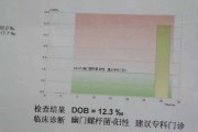 幽门螺杆菌值78严重吗,幽门螺旋杆菌指标范围