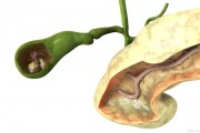 胆囊息肉怎么治疗最好的方法的简单介绍 胆囊息肉怎么治疗最好的方法的简单介绍