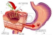 大部分人都有胃溃疡吗？