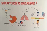为什么不建议年轻人做碳14,为什么不建议年轻人做碳14多少钱
