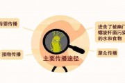 小孩为什么不用查幽门螺杆菌幽门螺旋杆菌阳性能治愈吗