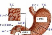 有胃炎的人能吃肉吗？