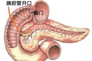 如果有十二指肠溃疡，做了胆囊摘除术，不断流入的胆汁会不会加重病情？