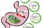幽门螺杆菌能喝酸奶吗幽门螺旋杆菌阳性可以根治吗
