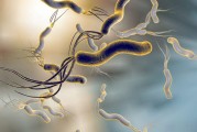 幽门螺杆菌感染的症状表现有哪些感染幽门螺杆菌有什么表现