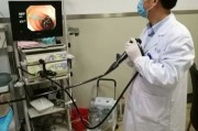 做胃镜检查需要提前做什么准备去哪西安胃泰医生做胃镜检查需要提前做什么准备