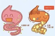 功能性腹泻是什么意思功能性腹泻