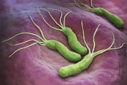 幽门螺杆菌是胃病的“罪魁祸首”？多吃三样东西来杀死细菌和炎症