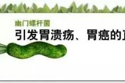 胃溃疡是什么病?该怎样防治? 胃溃疡是什么病?该怎样防治?
