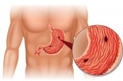 吃饭时的4种迹象，说明胃溃疡无疑，再不治疗就是胃癌了！指的是哪4点？