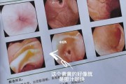 关于胃镜检查需要多少钱一次的信息