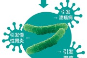 中医不建议杀幽门螺杆菌,幽门螺旋杆菌的治疗