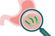 幽门螺旋杆菌感染有哪些症状传染吗的简单介绍