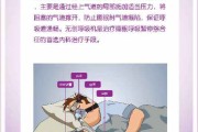 睡眠呼吸暂停低通气综合症,睡眠呼吸暂低通气综合症