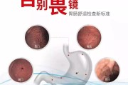 无痛胃镜检查,无痛胃镜检查后需要注意什么