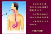 胃镜怎么做的过程多久胃镜怎么做的过程