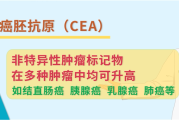 糖类抗原,糖类抗原242是什么肿瘤标志物