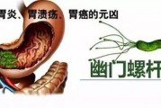 幽门螺杆菌1000严重吗幽门螺杆菌结果多少正常
