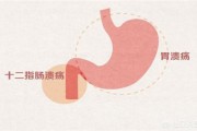胃十二指肠球部多发息肉、非萎缩性胃炎伴糜烂严重吗？