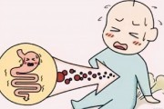 腹部胀气肚子胀怎么办小妙招 腹部胀气肚子胀怎么办小妙招
