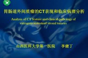 间质瘤是癌症吗间质瘤