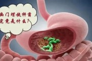 幽门螺旋杆菌hp强阳性,幽门螺旋杆菌阳性hp