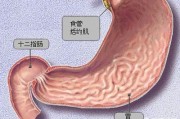 什么是十二指肠胃反流？