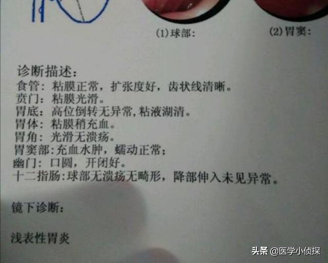 如何判断自己的胃病是否严重<strong>胃炎</strong>？
