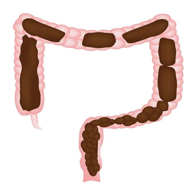 便便的形状<strong>肠道</strong>，能告诉我们哪些肠道健康秘密？