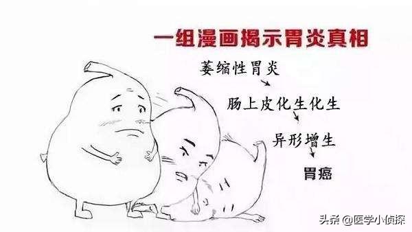如何判断自己的胃病是否严重<strong>胃炎</strong>？