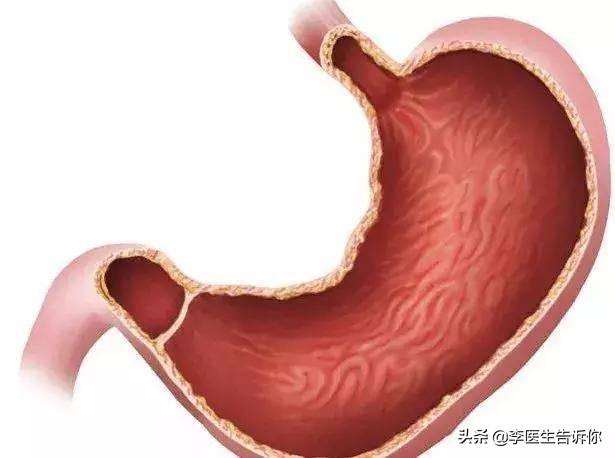 胃溃疡是萎缩性胃炎吗<strong>胃溃疡</strong>？容易癌变吗？