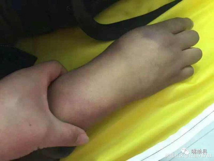 肠胃炎就诊黑诊所却丧命他乡<strong>肠胃炎</strong>，人性何存！