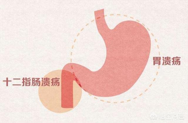 有胃溃疡的人能吃三七吗<strong>胃溃疡</strong>？为什么？