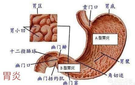 有胃炎的人能否吃南瓜<strong>胃炎</strong>？应该注意哪些实现？