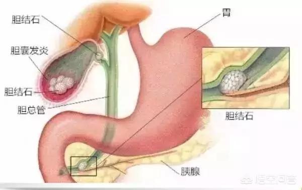 为什么人在呕吐时只能吐出胃里的食物而没有肠里的食物<strong>肠道</strong>？