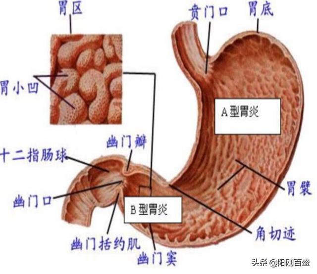 什么是慢性胃炎<strong>胃炎</strong>？该怎么治疗？