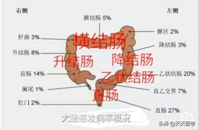 什么是肠道癌<strong>肠道</strong>？