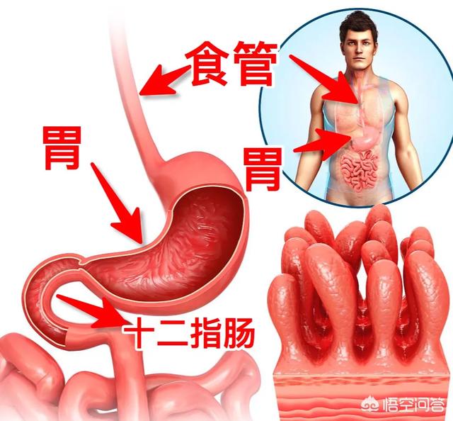 上腹痛一定是胃溃疡吗<strong>胃溃疡</strong>？如何区分十二指肠溃疡和胃溃疡？