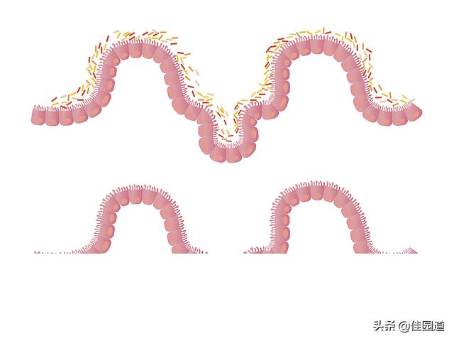 有人说肠癌不是悄无声息<strong>肠道</strong>，排便时可以体现出来，出现哪些迹象说明肠道已经明显损伤了？