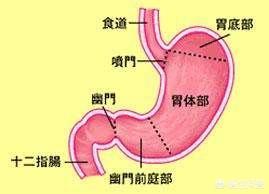 胃溃疡、十二指肠溃疡是一种很严重的病吗<strong>胃溃疡</strong>？